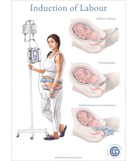 labor-delivery-services